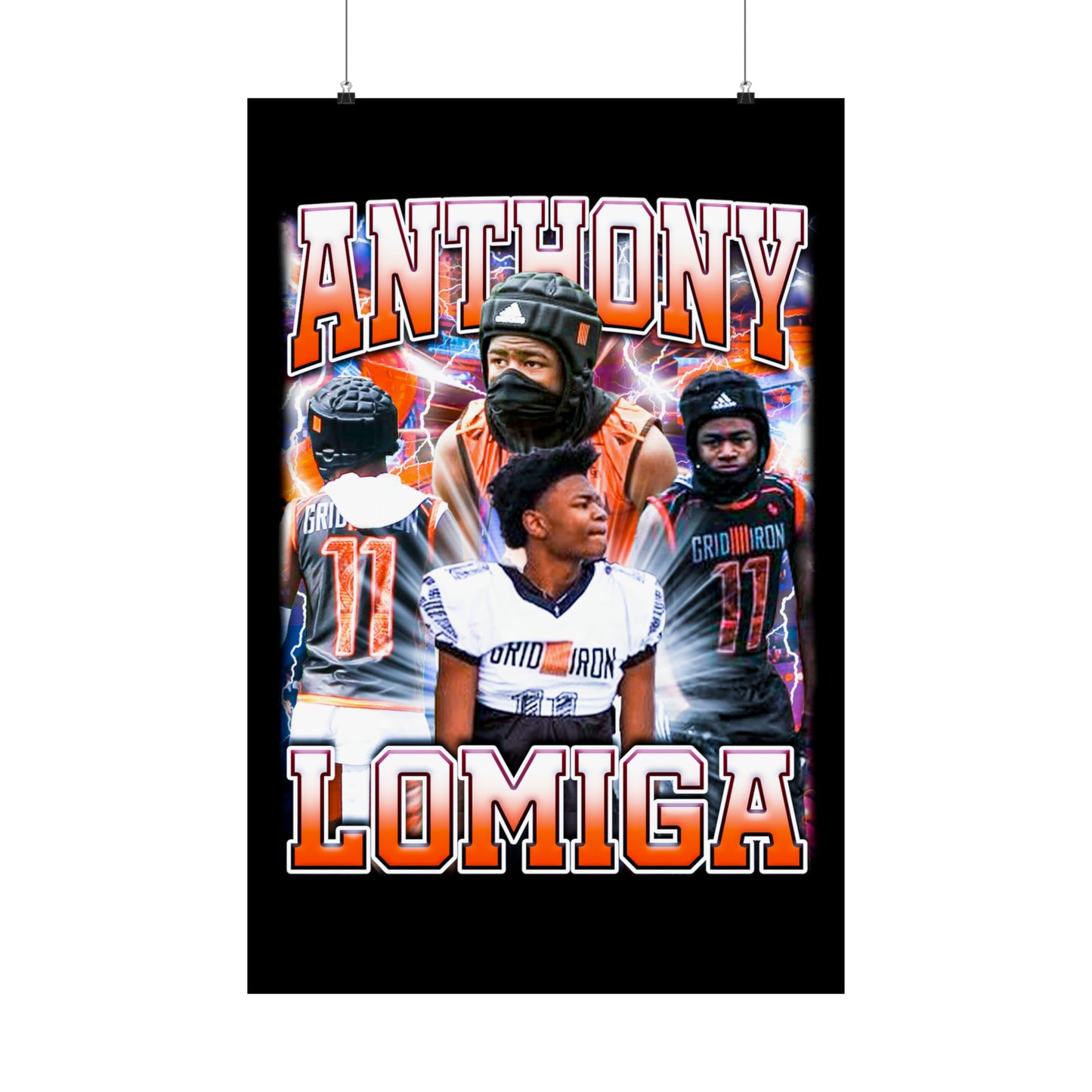 Anthony Lomiga Poster