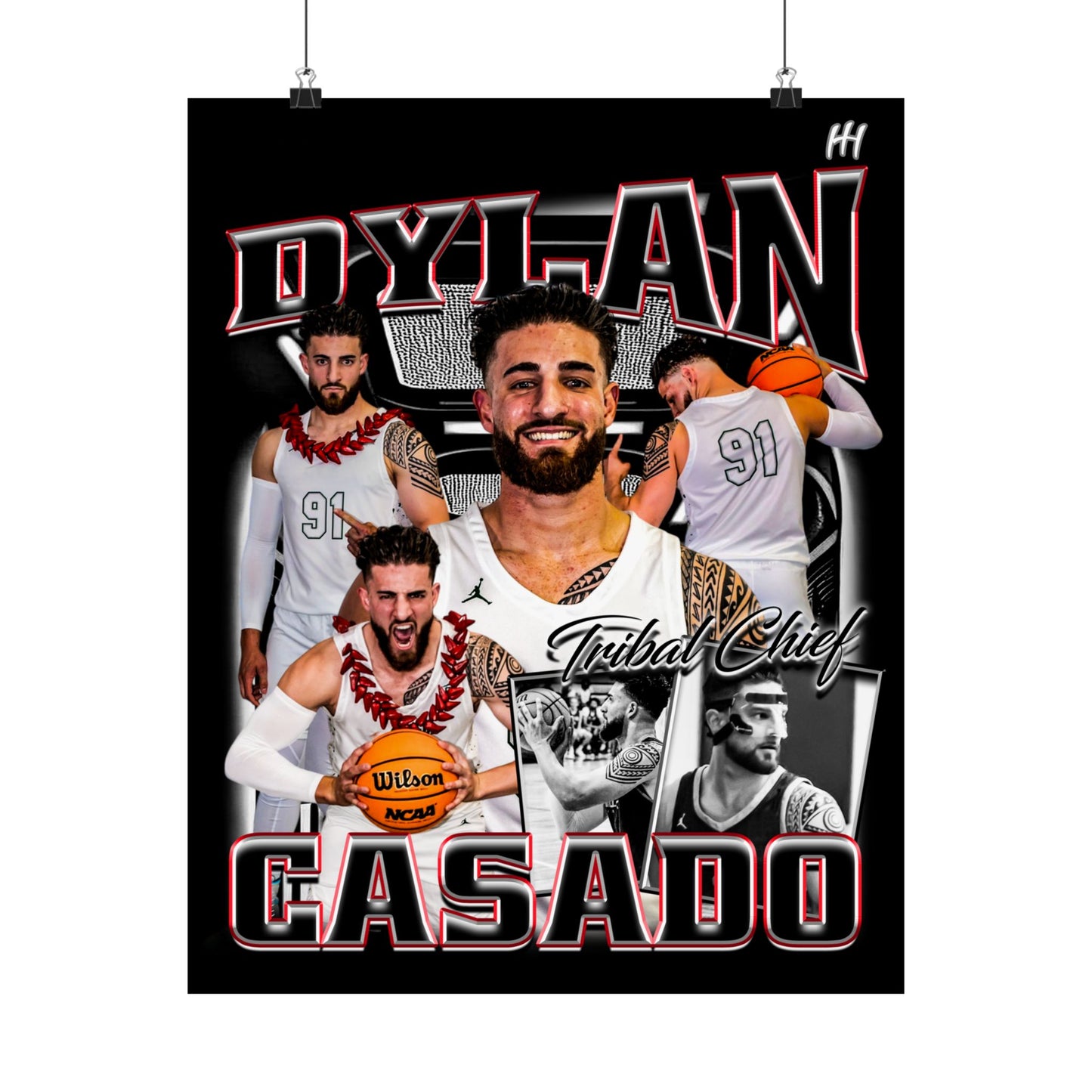Dylan Casado Poster - 16″ x 20″