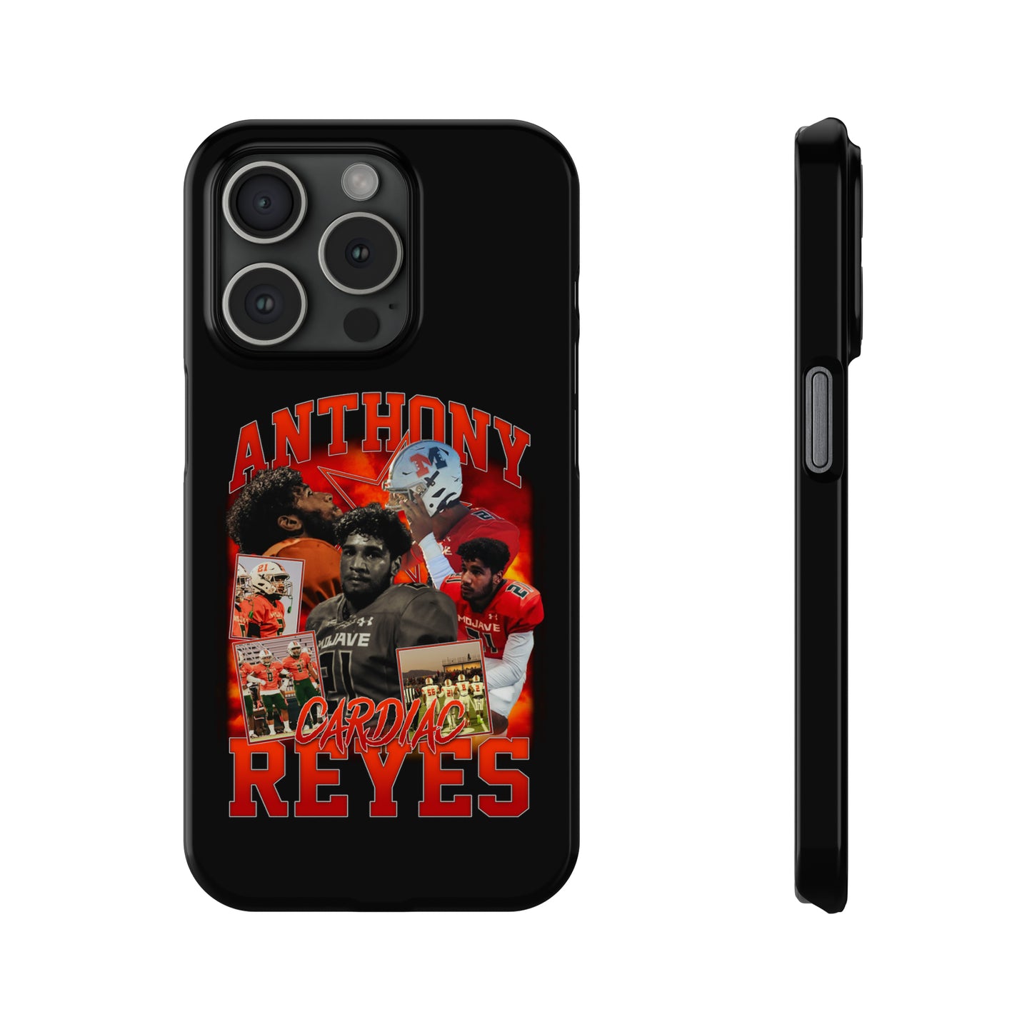 Anthony Reyes Phone Case